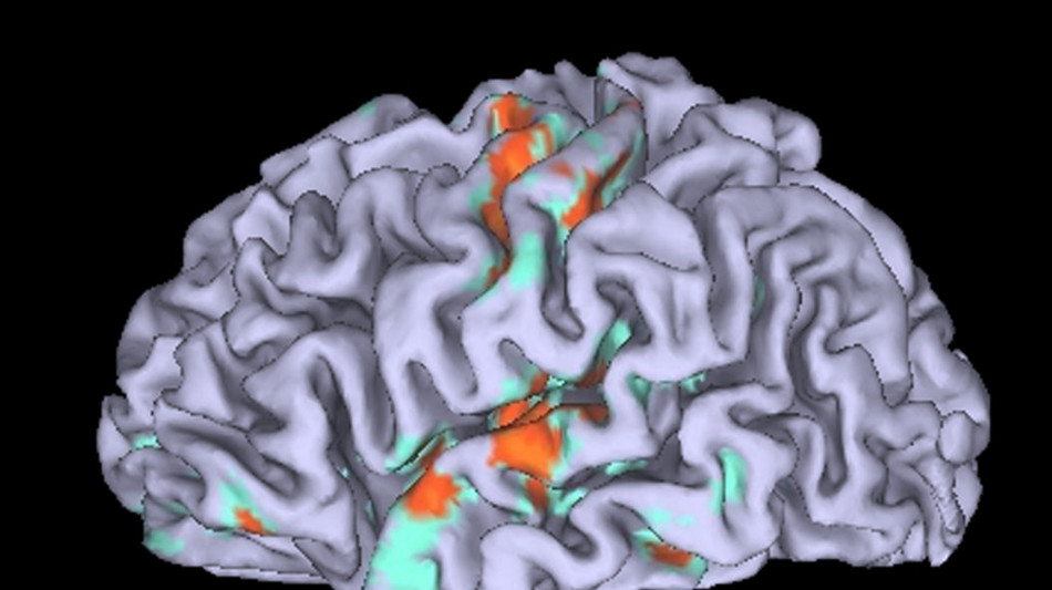 Il tempo si dilata quando il cervello apprende un nuovo movimento