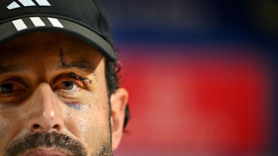 Incidents OM/OL: Grosso attend "des d&eacute;cisions importantes" pour am&eacute;liorer la s&eacute;curit&eacute;