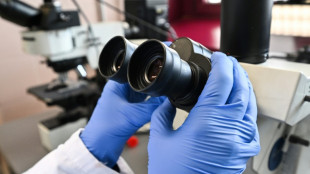 Des simili-embryons humains au coeur d'une vive rivalit&eacute; entre chercheurs