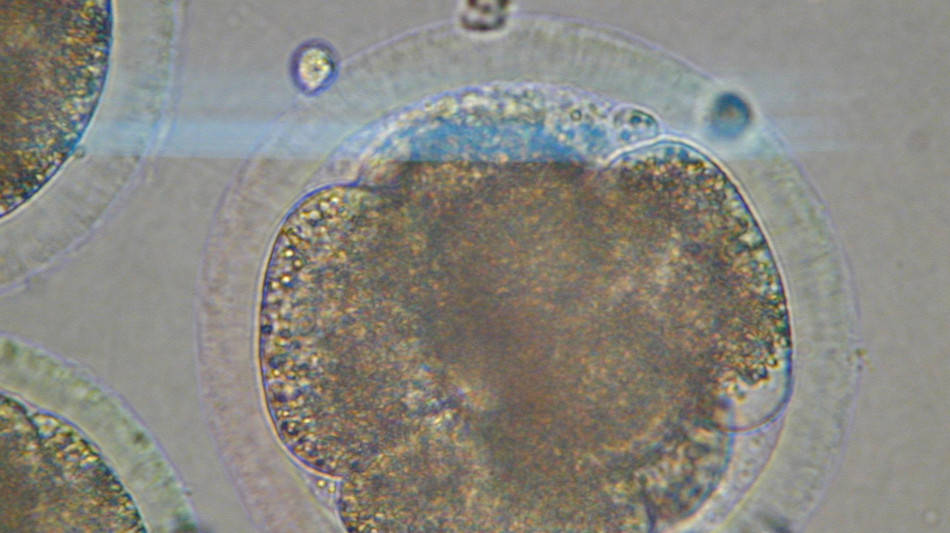 L'invecchiamento rimodella le cellule dei mammiferi