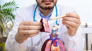 Embolia polmonare e tumori, un algoritmo potrebbe evitare una Tac su 5