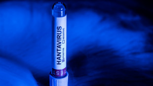 Hantavirus: pour les experts, le d&eacute;fi d'informer sans r&eacute;veiller la peur du Covid