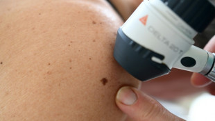 Les dermatologues à fleur de peau sur la question de leurs effectifs