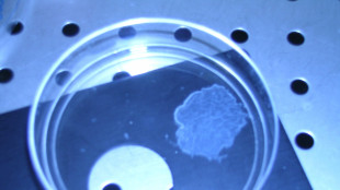 C'&egrave; un legame tra rigidit&agrave; dei tessuti e progressione dei tumori