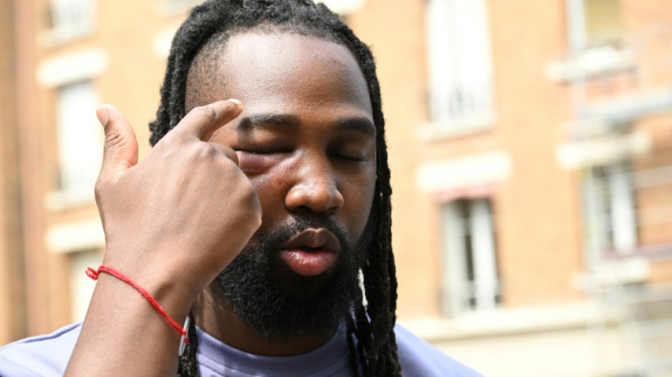 Marche interdite: Youssouf Traor&eacute; est sorti de l'h&ocirc;pital, rassemblement devant un commissariat